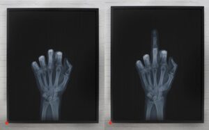 Middle Finger X-Ray Artwork