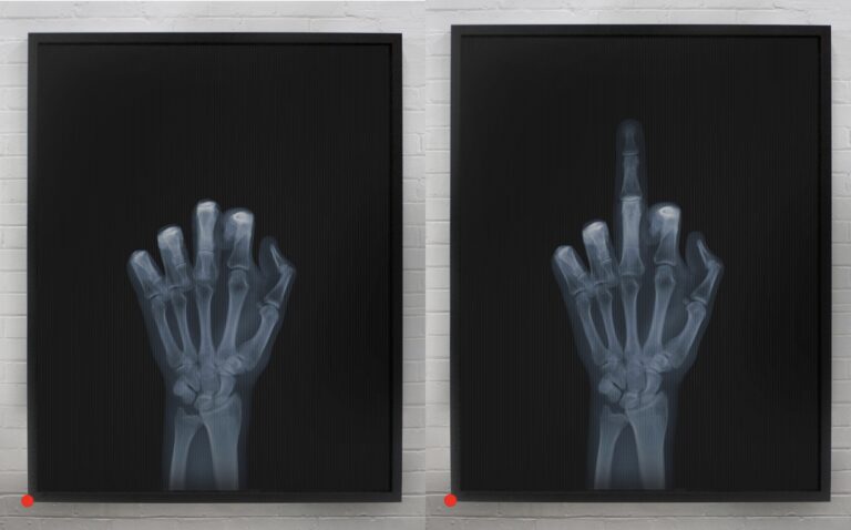 Middle Finger X-Ray Artwork