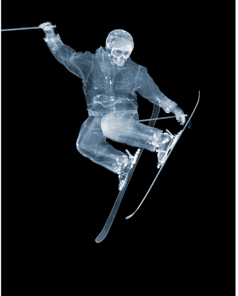 Skier